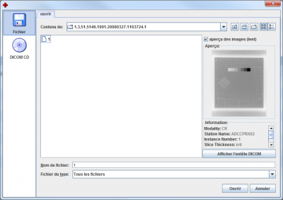 Sélection des images DICOM à importer